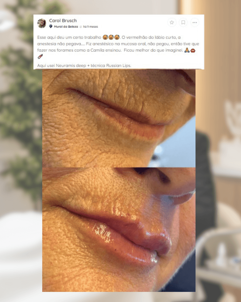 Resultado Carol Bruch