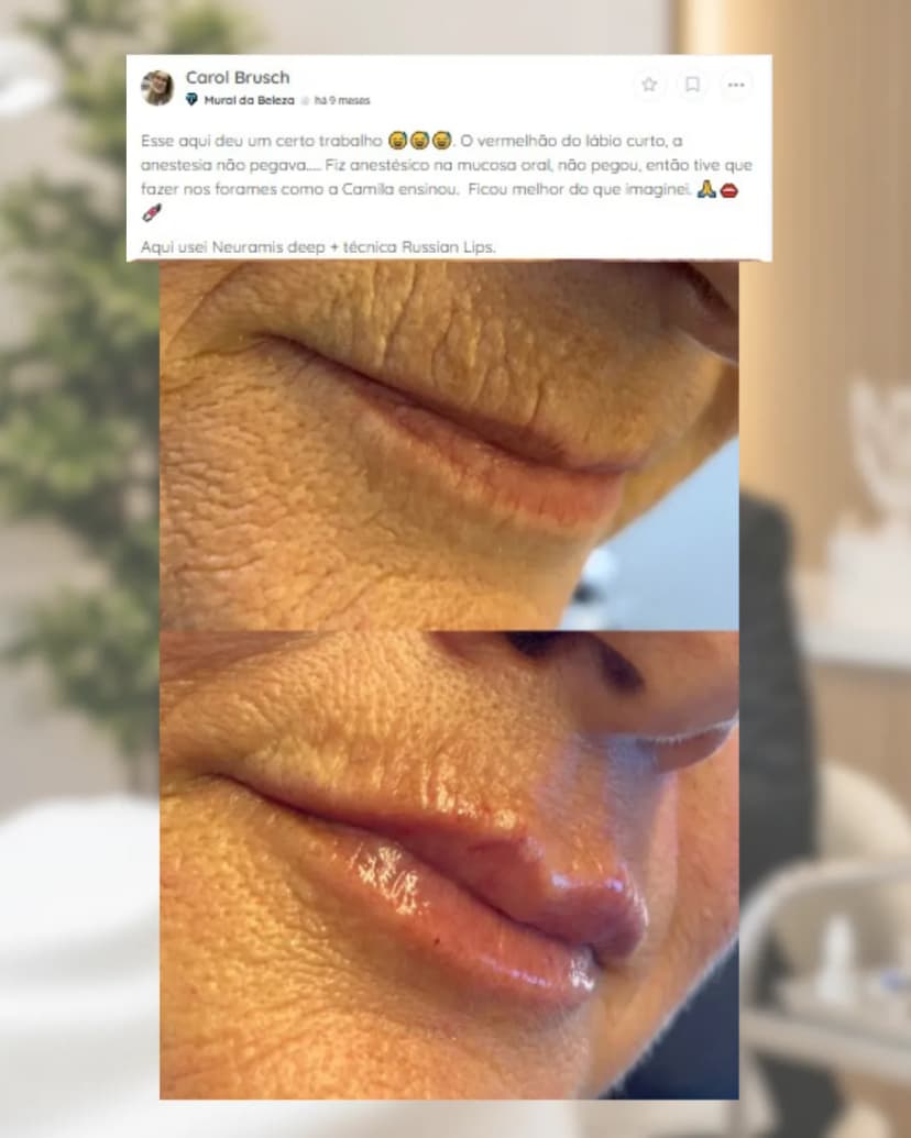 Resultado Carol Bruch